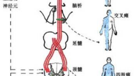 上运动神经元的胞体位于大脑皮质躯体运动区的锥体细胞,其轴突组成下行的锥体束吗