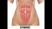 腹直肌是肌肉吗？